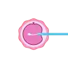 IVF