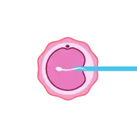 IVF
